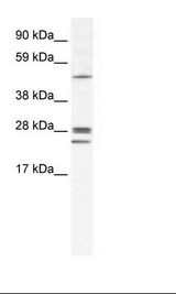 Fetal Lung Lysate