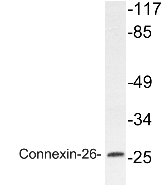 Western blot of Connexin-26 (H94) pAb in extracts from Jurkat cells.