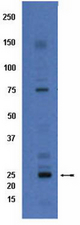 Western Blot/Immunoblot analysis of Rabbit anti-Connexin 26 at 0.1 ug/mL on adult mouse liver lysate. Arrow indicates expected band approximately 26 kDa.