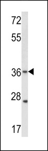 Western blot of hGJB3-C241 in WiDr cell line lysates (35 ug/lane). GJB3 (arrow) was detected using the purified antibody.(2 ug/ml)