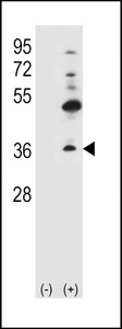 Western blot of GJB4 (arrow) using rabbit polyclonal GJB4 Antibody (H105.Connexin). 293 cell lysates (2 ug/lane) either nontransfected (Lane 1) or transiently transfected (Lane 2) with the GJB4 gene.