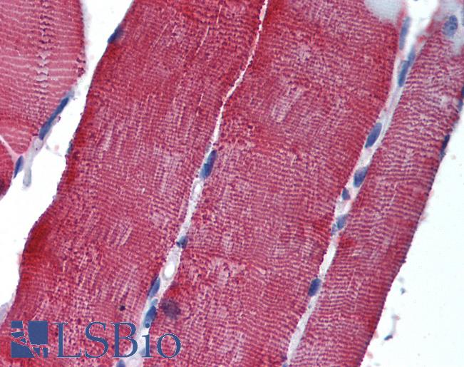 Anti-GJB6 antibody IHC of human skeletal muscle. Immunohistochemistry of formalin-fixed, paraffin-embedded tissue after heat-induced antigen retrieval. Antibody LS-B2112 concentration 5 ug/ml.