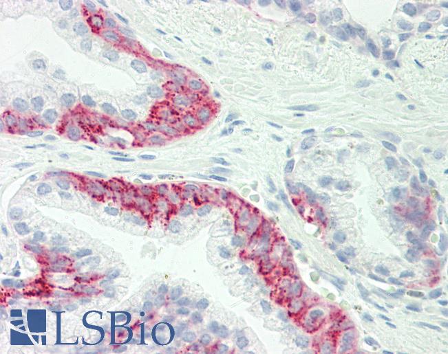 Anti-GJC1 / CX45 / Connexin 45 antibody IHC staining of human prostate. Immunohistochemistry of formalin-fixed, paraffin-embedded tissue after heat-induced antigen retrieval. Antibody LS-B10244 concentration 10 ug/ml.