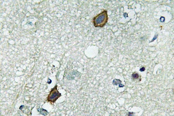 IHC of Connexin-45 (N361) pAb in paraffin-embedded human brain tissue.