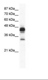 Jurkat Cell Lysate