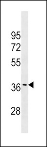 GJC3 Antibody western blot of MDA-MB453 cell line lysates (35 ug/lane). The GJC3 antibody detected the GJC3 protein (arrow).