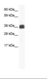 Fetal Skeletal Muscle Lysate