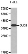 Western blot analysis of extracts of HeLa cell line, using GJD2 antibody.