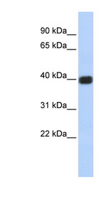GJD2 / Connexin 36 antibody LS-C101642 Western blot of Jurkat lysate.