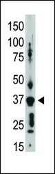 The anti-GJA9 C-term antibody is used in Western blot to detect GJA9 in placenta tissue lysate.