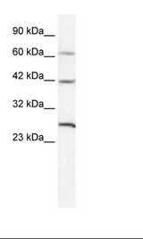 HepG2 Cell Lysate