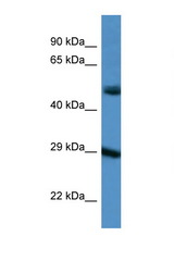 GJD3 antibody LS-C145592 Western blot of 293T Cell lysate. Antibody concentration 1 ug/ml.