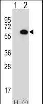 Western blot of GK (arrow) using rabbit polyclonal GK Antibody. 293 cell lysates (2 ug/lane) either nontransfected (Lane 1) or transiently transfected (Lane 2) with the GK gene.
