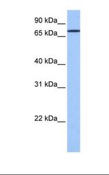 Fetal brain cell lysate. Antibody concentration: 1.0 ug/ml. Gel concentration: 12%.