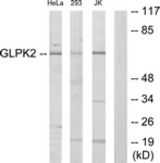 Western blot of extracts from HeLa/293/Jurkat cells, using GK2 Antibody. The lane on the right is treated with the synthesized peptide.