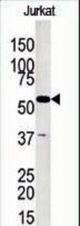 The anti-GKP2 antibody is used in Western blot to detect GKP2 in Jurkat tissue lysate
