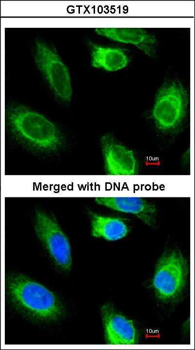 Immunofluorescence of paraformaldehyde-fixed HeLa using glycerol kinase 2 antibody at 1:200 dilution.