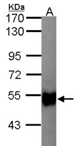 Sample (30 ug of whole cell lysate). A: Hep G2 . 7.5% SDS PAGE. glycerol kinase 2 antibody. GK2 / Glycerol Kinase 2 antibody diluted at 1:1000.