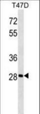 GK5 Antibody western blot of T47D cell line lysates (35 ug/lane). The GK5 antibody detected the GK5 protein (arrow).