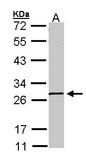 Sample (30 ug of whole cell lysate). A: A431 . 10% SDS PAGE. GK5 antibody diluted at 1:1000