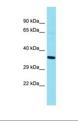Western blot of Human Fetal Kidney. GKAP1 antibody dilution 1.0 ug/ml.