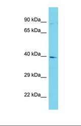 Western blot of Human HCT15. GKAP1 antibody dilution 1.0 ug/ml.