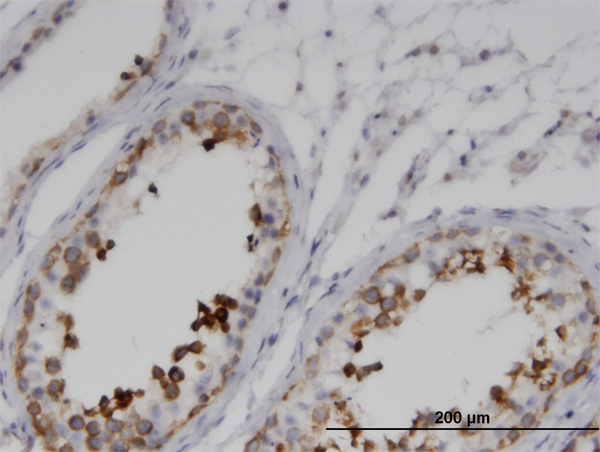 Immunoperoxidase of monoclonal antibody to GKAP1 on formalin-fixed paraffin-embedded human testis. [antibody concentration 3 ug/ml]