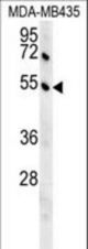 GKAP1 Antibody western blot of MDA-MB435 cell line lysates (35 ug/lane). The GKAP1 antibody detected the GKAP1 protein (arrow).