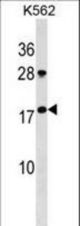GKN1 Antibody western blot of K562 cell line lysates (35 ug/lane). The GKN1 antibody detected the GKN1 protein (arrow).