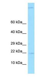 GKN2 antibody Western Blot of Fetal Liver.