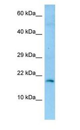 GKN2 antibody Western Blot of Fetal Brain.