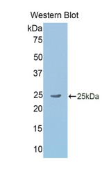 Western blot of recombinant GKN2 / Gastrokine 2.