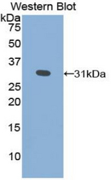 Western blot of recombinant GLA / Alpha Galactosidase.