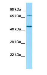 GLB1 / Beta-Galactosidase antibody Western Blot of 721_B.