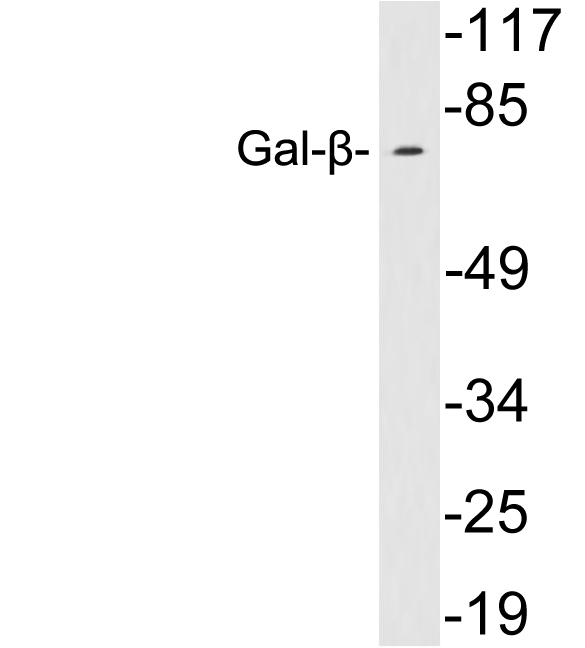 Western blot of extracts from 293 cells, using Gal- beta antibody.