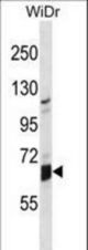 GLB1L Antibody western blot of WiDr cell line lysates (35 ug/lane). The GLB1L antibody detected the GLB1L protein (arrow).