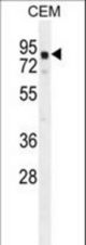 GLB1L2 Antibody western blot of CEM cell line lysates (35 ug/lane). The GLB1L2 antibody detected the GLB1L2 protein (arrow).