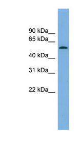 GLCCI1 antibody LS-C116499 Western blot of Fetal Brain lysate.