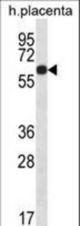 GLCCI1 Antibody western blot of human placenta tissue lysates (35 ug/lane). The GLCCI1 antibody detected the GLCCI1 protein (arrow).