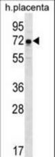 GNE Antibody western blot of human placenta tissue lysates (35 ug/lane). The GNE antibody detected the GNE protein (arrow).