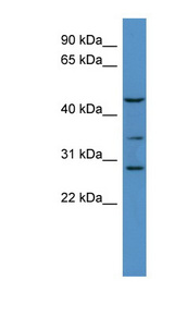 B3GALT2 antibody LS-C135180 Western blot of Mouse Brain lysate.