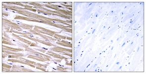 IHC of paraffin-embedded human heart tissue, using B3GALT2 Antibody. The sample on the right was incubated with synthetic peptide.