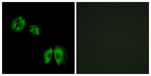 Immunofluorescence of A549 cells, using B3GALT2 Antibody. The sample on the right was incubated with synthetic peptide.