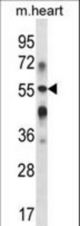 B3GALT2 Antibody western blot of mouse heart tissue lysates (35 ug/lane). The B3GALT2 antibody detected the B3GALT2 protein (arrow).