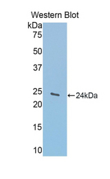 Western blot of recombinant GLDC.