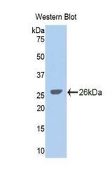 Western blot of recombinant GLDC.