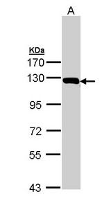 Sample (30 ug of whole cell lysate). A: HeLa. 7.5% SDS PAGE. GLDC antibody diluted at 1:1000