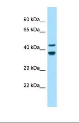 Western blot of Human Fetal Brain. GLDN antibody dilution 1.0 ug/ml.
