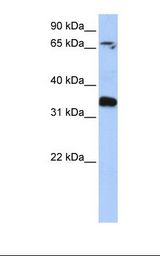Placenta lysate. Antibody concentration: 1.0 ug/ml. Gel concentration: 12%.