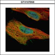 Confocal immunofluorescence analysis (Olympus FV10i) of paraformaldehyde-fixed HeLa using GLE1 antibody (Green) at 1:500 dilution. Alpha-tubulin filaments were labeled with alpha-tubulin antibody (Red) at 1:2500.